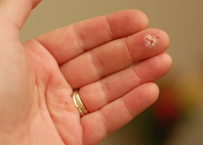 finger.jpg